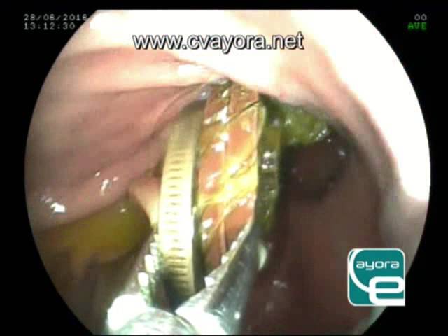 Mi Perro se Tragó una Moneda: Pasos a Seguir y Posibles Complicaciones 1 que pasa si mi perro se traga una moneda